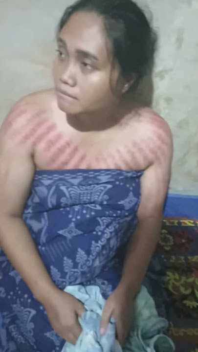 Kerokan Dada Mbk Zahra .