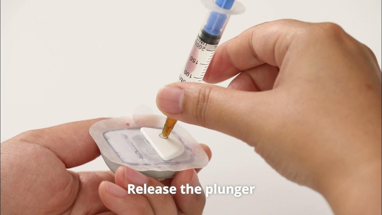 Fill + Activate Medtrum Nano Insulin Pump using EasyPatch App Smartphone Control English (2021