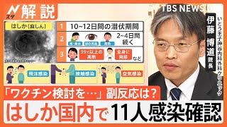 【医師が解説】はしか 国内で11人感染確認、はしかワクチン 2回目必要？ 副反応は？【Nスタ解説】｜TBS NEWS DIG