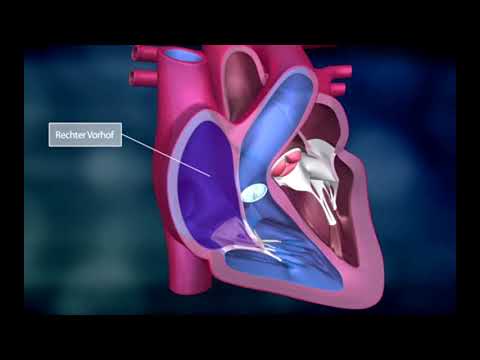 Video: Wie fließt das Blut in das Herz ein und aus?