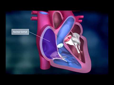 Video: Wie beende ich das rote Herz?