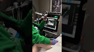 Lower Extremity DVT ultrasound exam with Taryne