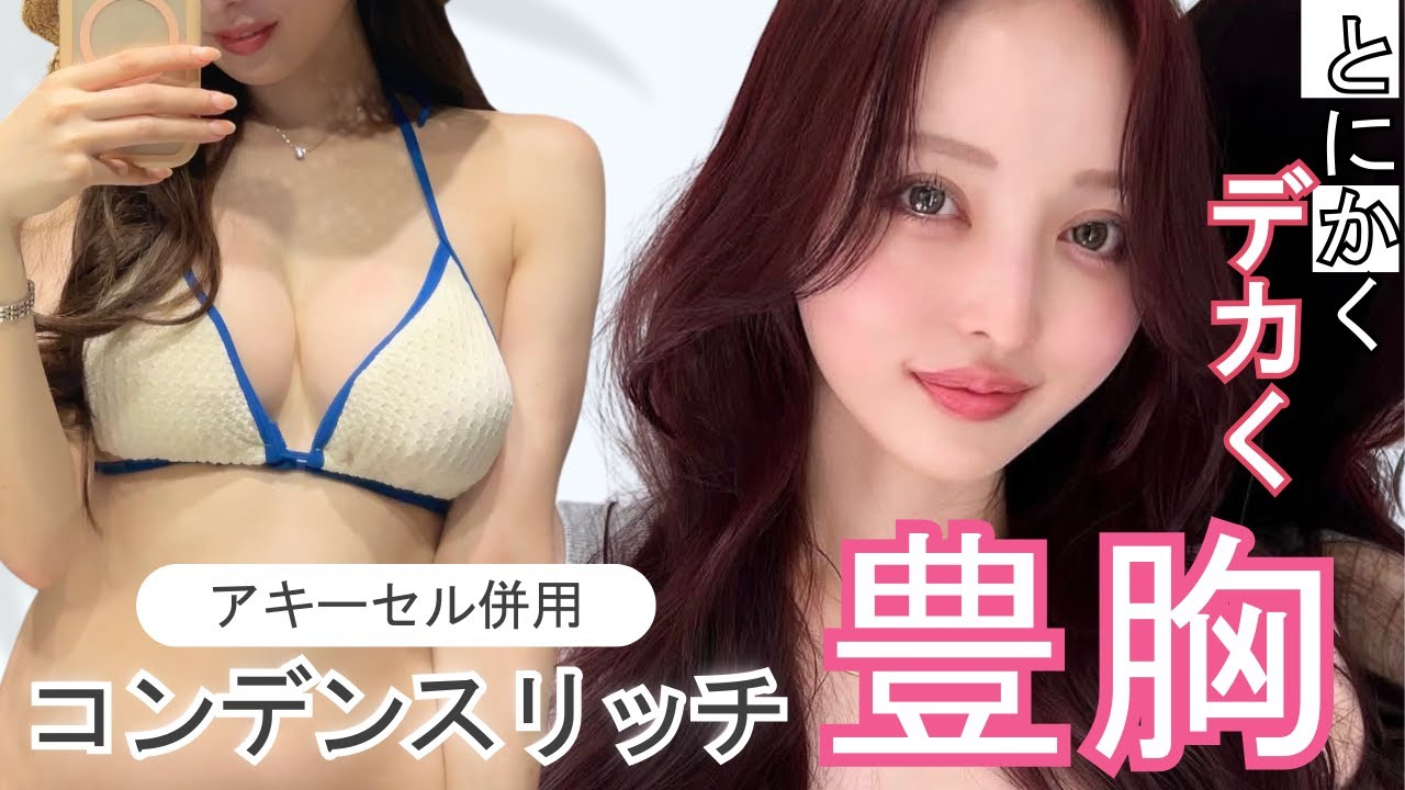 豊胸でとにかくデカく！｜《東京》SBC Regno銀座院で20代女性の脂肪