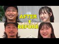 【40歳整形レポ】糸リフトと脂肪吸引で大変なことに…😱😱😱