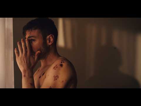 SCAB | Official Teaser | Body Horror