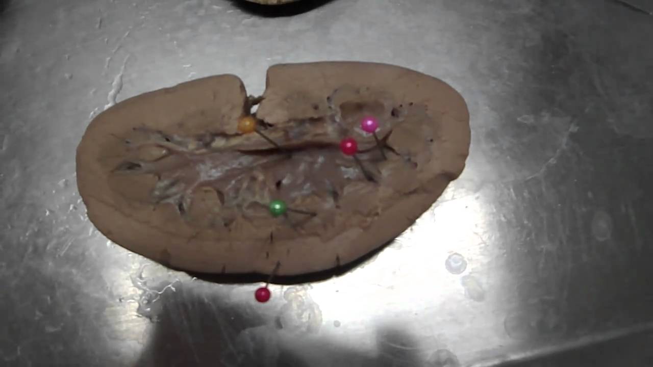 ANATOMIA VETERINÁRIA - Rim de suíno - YouTube