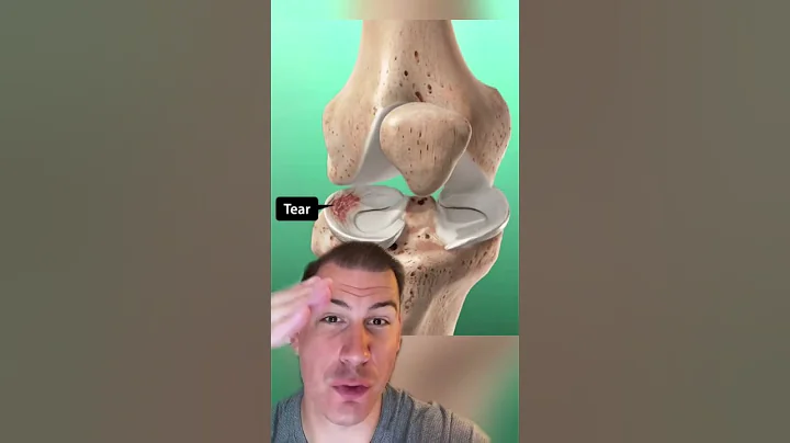 Knee Clicking - DayDayNews