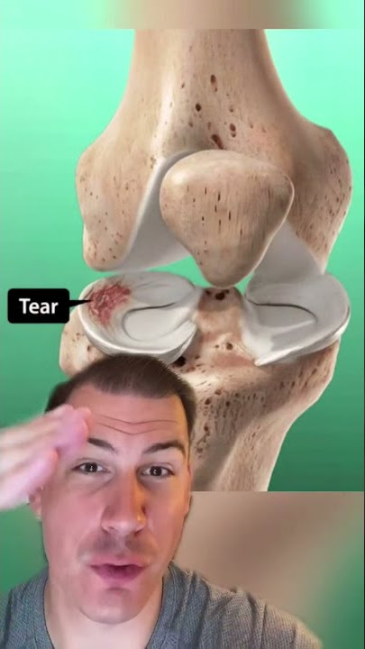 Knee Clicking