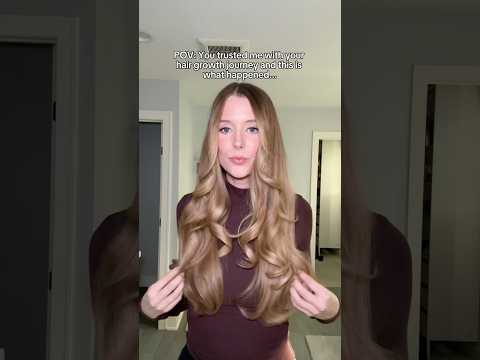 YOUR insane hair