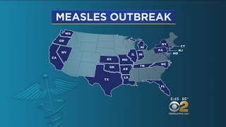 CDC: Measles Outbreak Spreads To 21 States