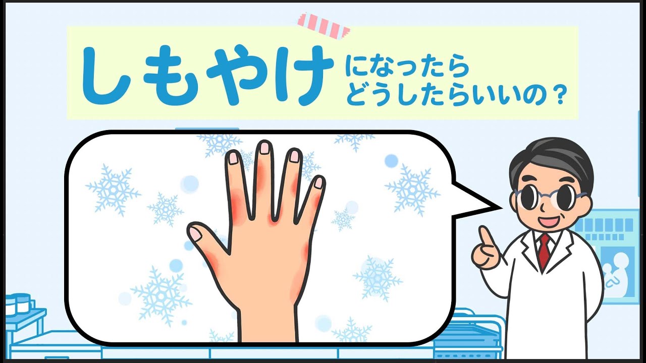 しもやけ 原因は 対処方法は かゆみがひどい時は 受診は必要 株式会社プレシジョン