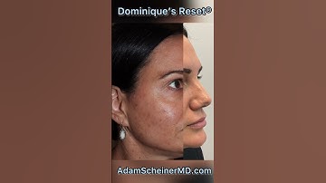 "I hit the RESET Button. It’s been life changing”