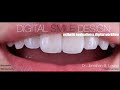 Identify-Visualize-Choose: A 3-Step Approach to Full Facial Esthetics-driven Smile Design