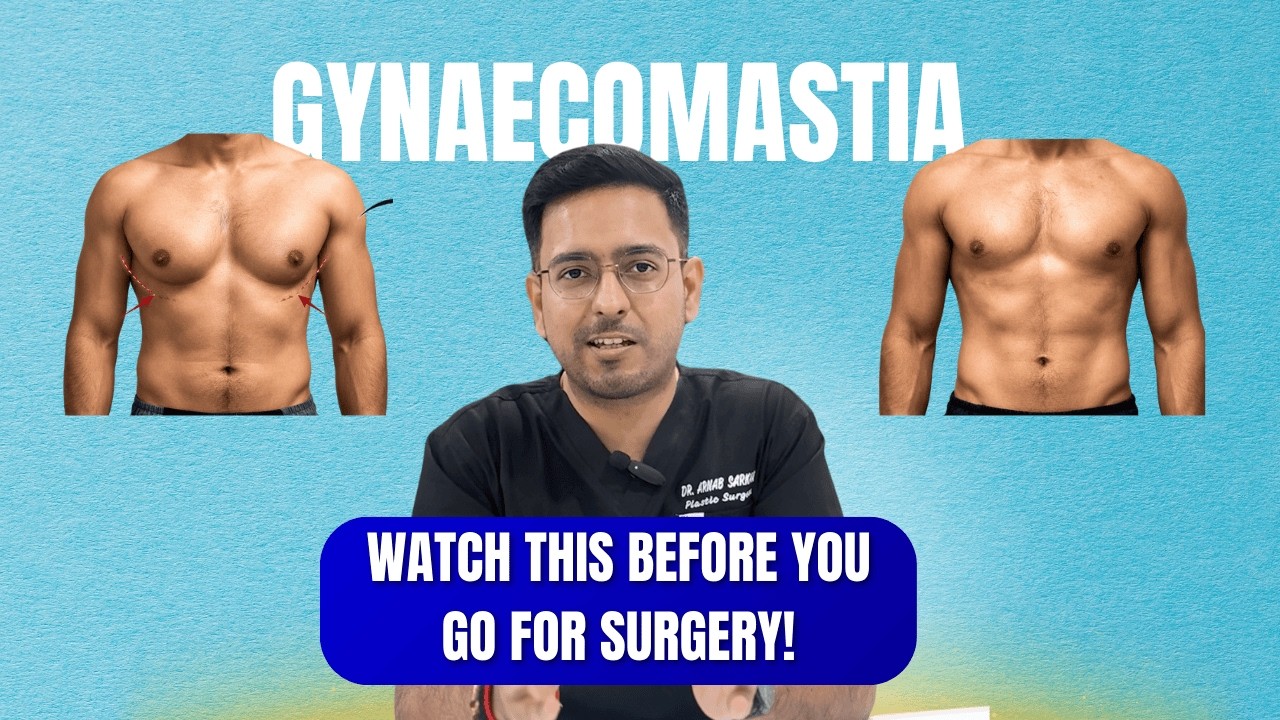 Gynecomastia Explained: Causes, Symptoms & the REAL Treatment Options