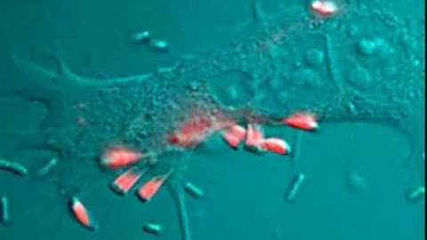 Enteropathogenic E. coli (EPEC) infected fibroblast cell