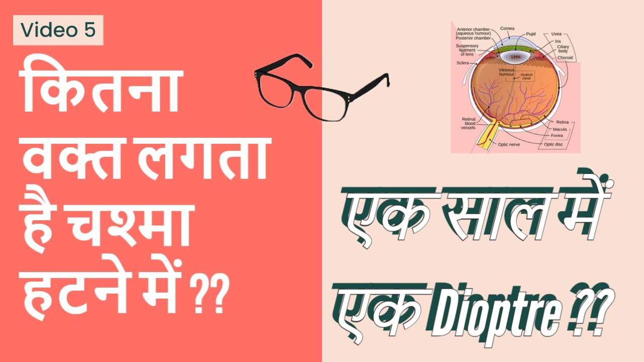 Myopia sahi karne me kitna time lagta hai? YouTube