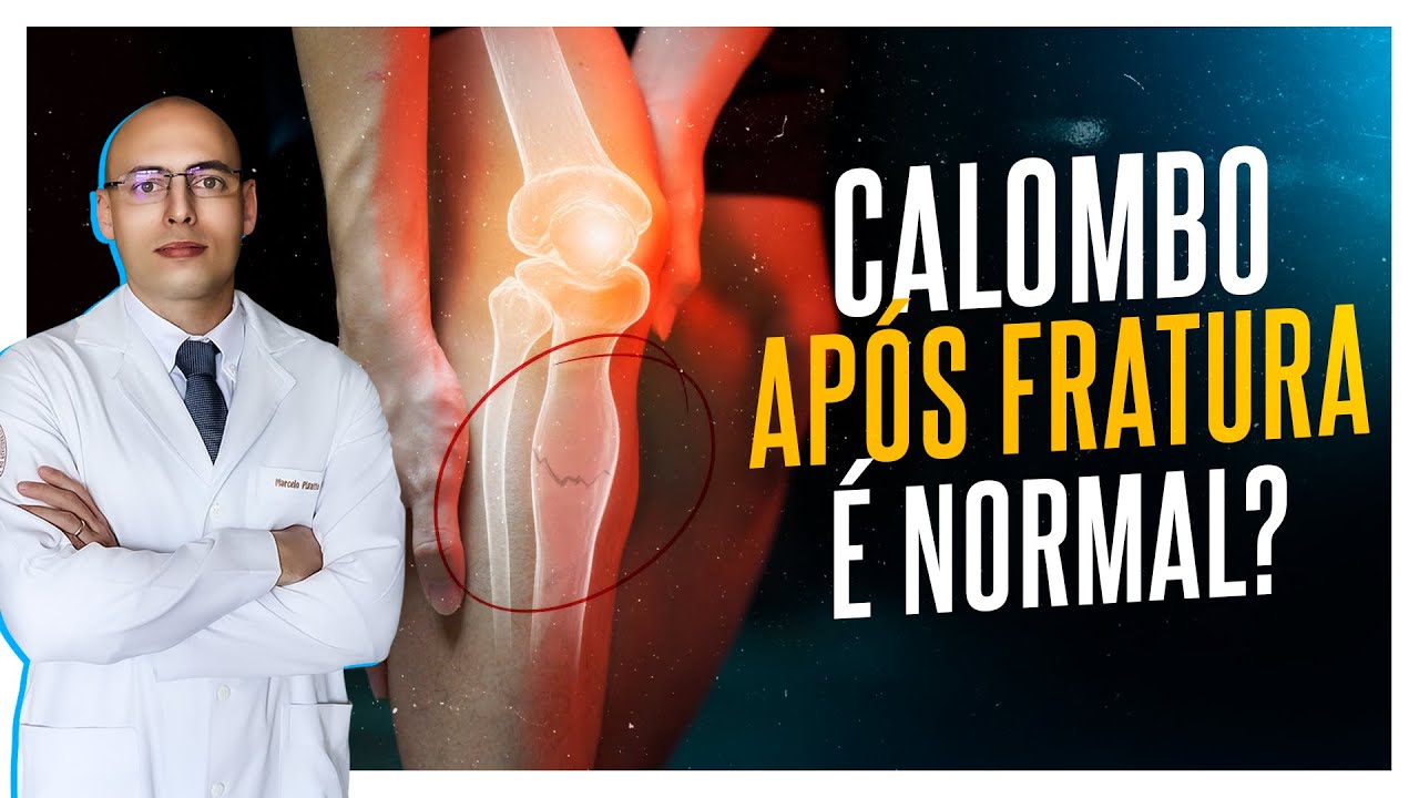 CALOMBO NA FRATURA| É NORMAL? O QUE É?