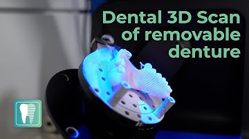SCANTIST 3D | Стоматологическое 3D-сканирование съемного протеза