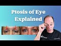 Ptosis of the Eye Explained | Eyelid Surgery for Droopy Eyelids