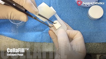 CollaFill Collagen Plug as a Dental Membrane