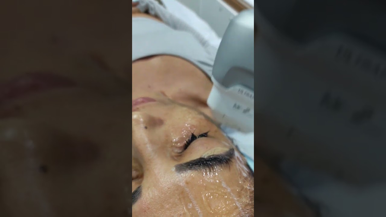 como melhorar o enrrugado da pálpebra?  pálpebra enrrugada, como melhorar? 