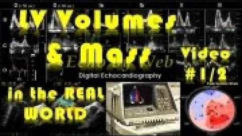 Echocardiographic analysis of LV volumes & mass_Video 1