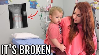 Our baby BROKE his arm