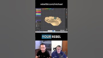 No-Adjustment Abutment & Crown: Atlantis & Rebel Crown with Dr. Michael Cimino