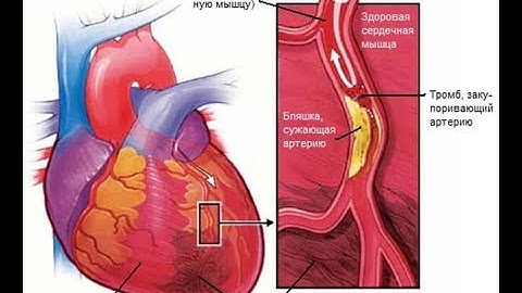Повышенный холестерин пришел в норму.  Результаты клеточного питания APL  Отзывы, результаты.