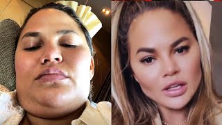 Chrissy Teigen Is Unrecognizable in New Photos—Is Ozempic to Blame?