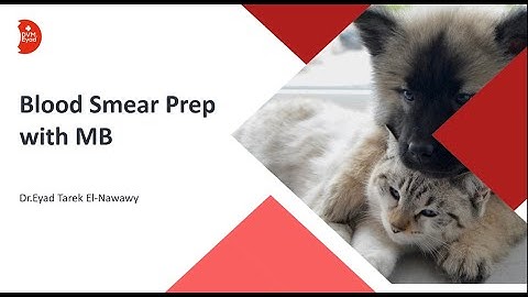 How to Prepare a Blood Smear with Methylene Blue | Heinz Bodies & Reticulocytes Explained