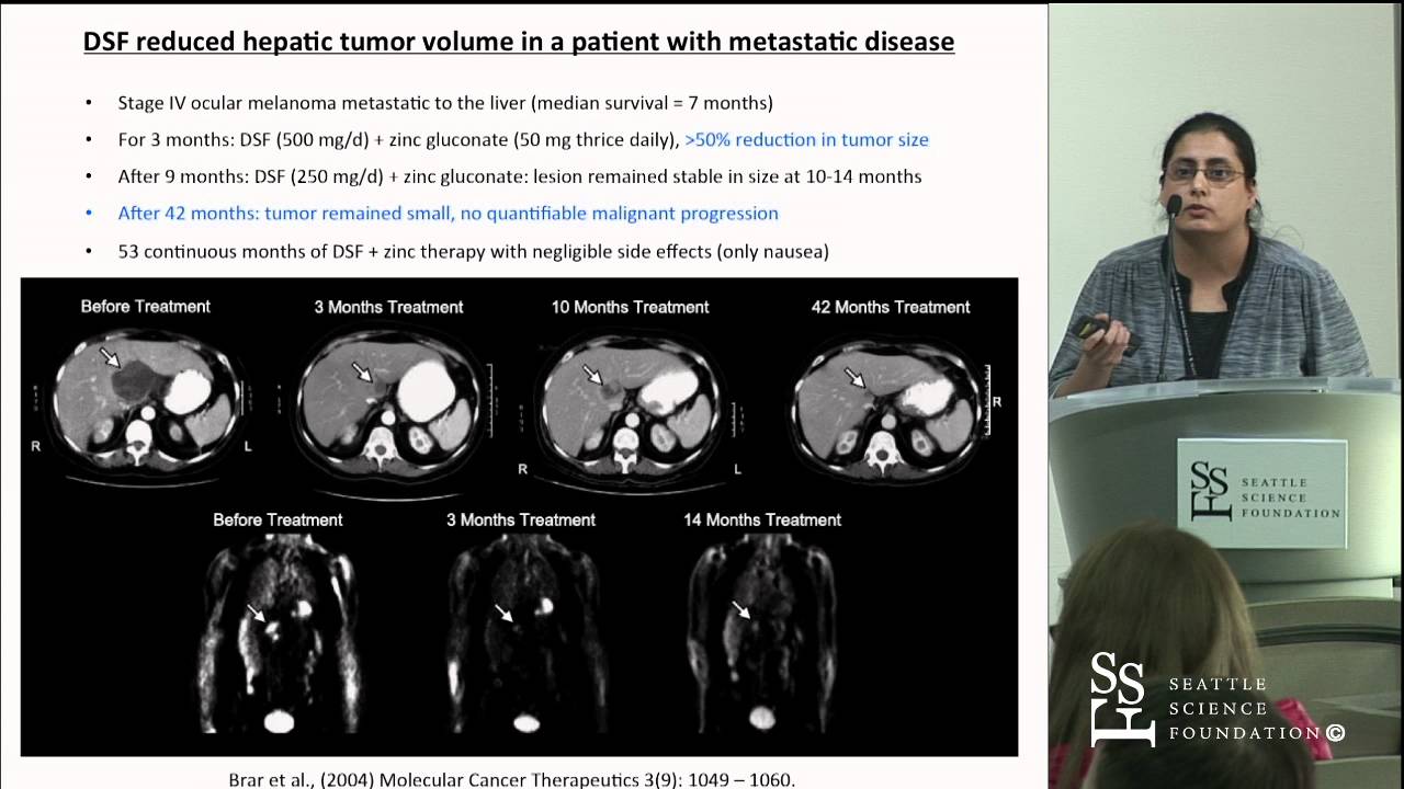 Drug Therapy for Glioblastoma Based on Personalized Cancer Stem Cell by