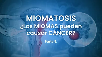 ¿Los miomas suelen ser cancerosos?