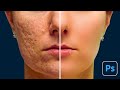 How to Smooth Skin in Photoshop
