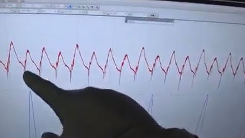 HOW RELATIVE COMPRESSION TESTS CAN FOOL YOU