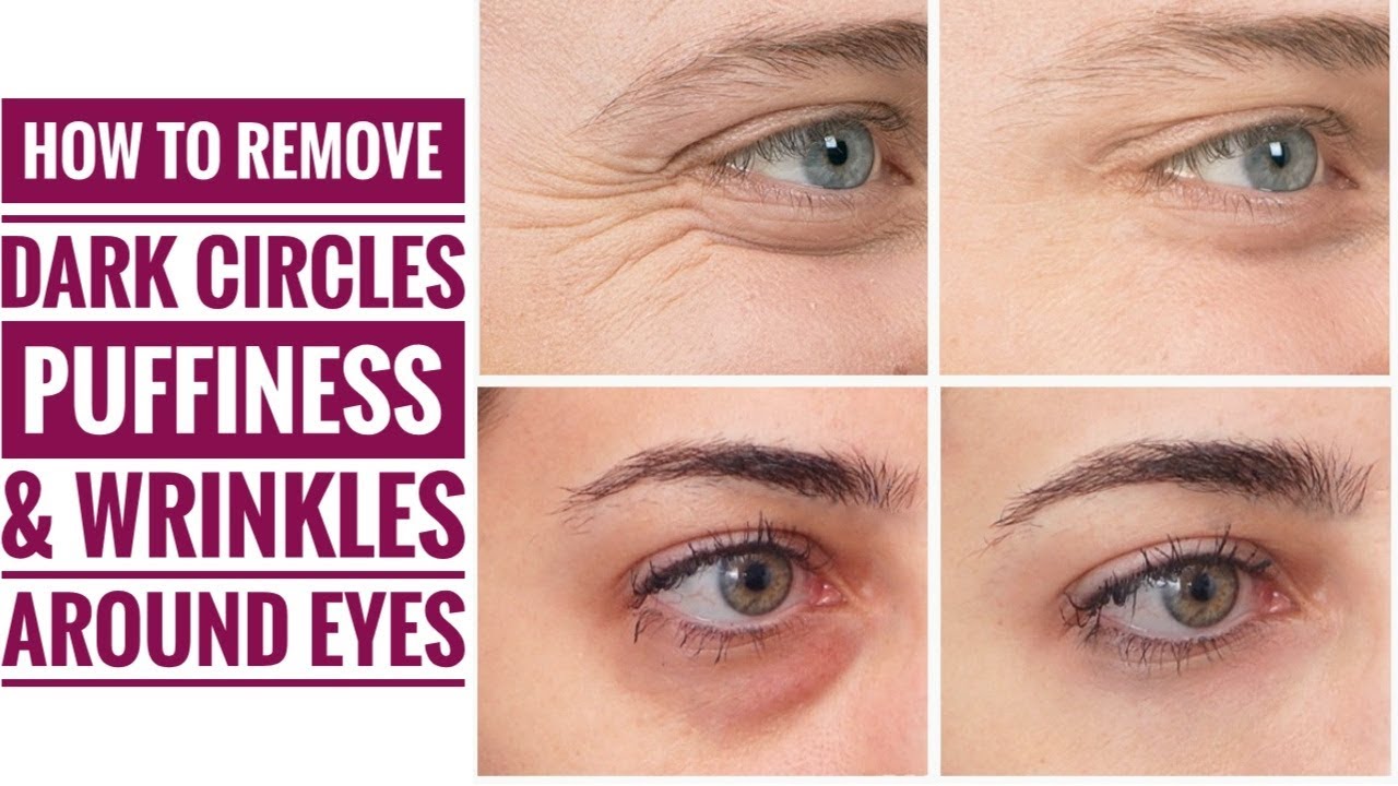Diy Under eye cream / remove dark circles,eye puffiness and wrinkles