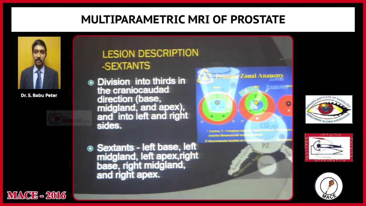Multiparametric MRI of Prostate - YouTube