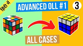 Advanced Oll (All cases)| Advanced Oll (in hindi) (PART 1) All cases