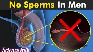 Infertility In Males Due To No Sperms (Azoospermia)animation azoospermia malereproductivesystem