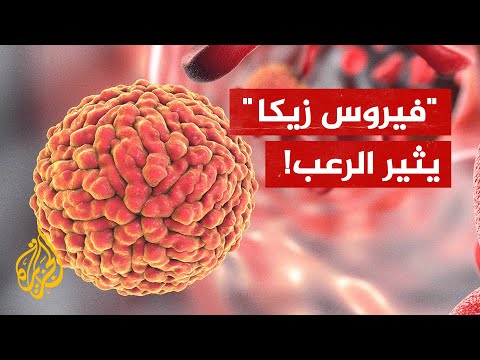 يسبب ولادة أطفال برؤوس صغيرة.. علماء يحذرون من فيروس زيكا
