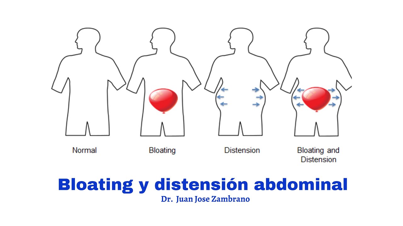 Como reducir la distensión abdominal