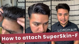 Receding Hairline? A Simple Way To Solve It Wear A Frontal Hair System Lordhair Mens Hairpieces