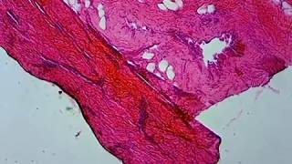 Human skin section with sweat gland Under the microscope