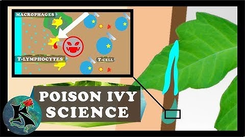 What Poison Ivy Does to Your Skin (Basic Science) | Koaw Nature