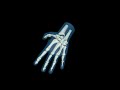 Design Video: Pediatric Hand for X-Ray CT, MRI