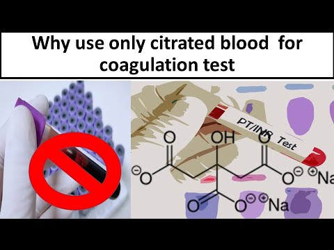 Wideo: Kiedy używa się krwi cytrynianowej?