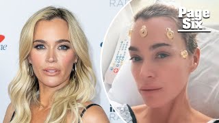 Teddi Mellencamp shares symptoms that led to brain tumor discovery in ABC News interview