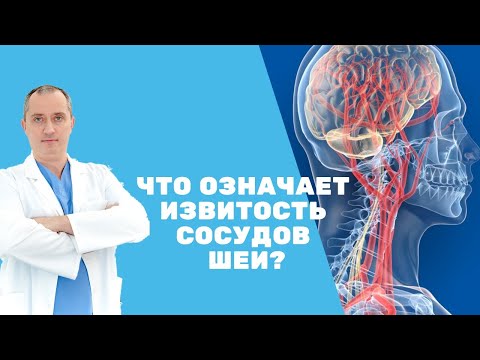 Видео: Что означает извилистость?