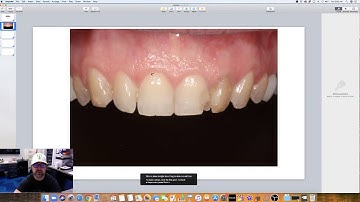 Keynote - Smile Design Part 1 - Basics of Keynote