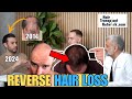 How i reversed my hair loss with lifeaszeph and dr mohebi